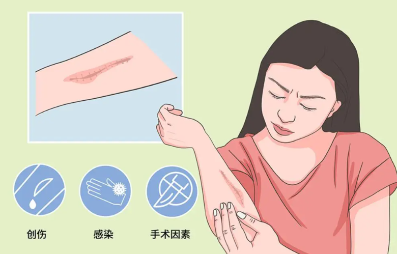 上海健橋醫(yī)院疤痕科