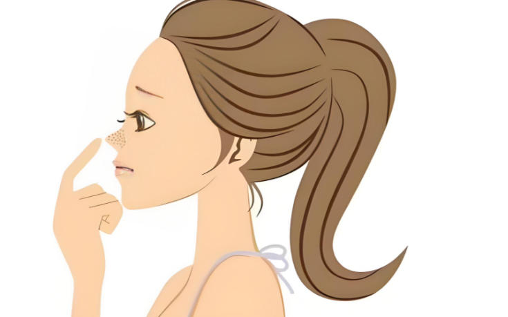 什么是“云梯式隆鼻”?www.aimei.com