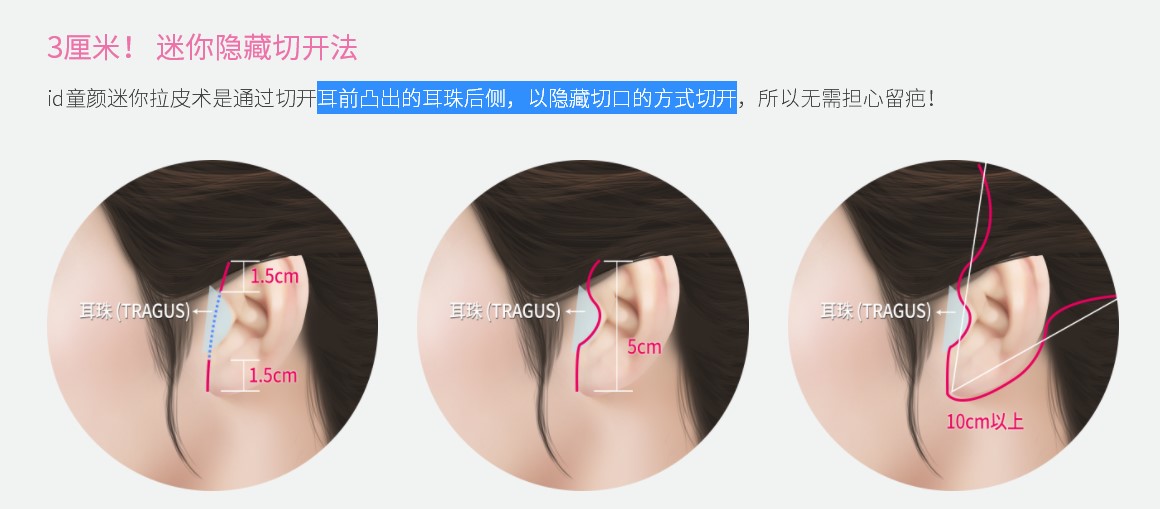 秦宏智医生的背景与临床优势：为什么能做好拉皮