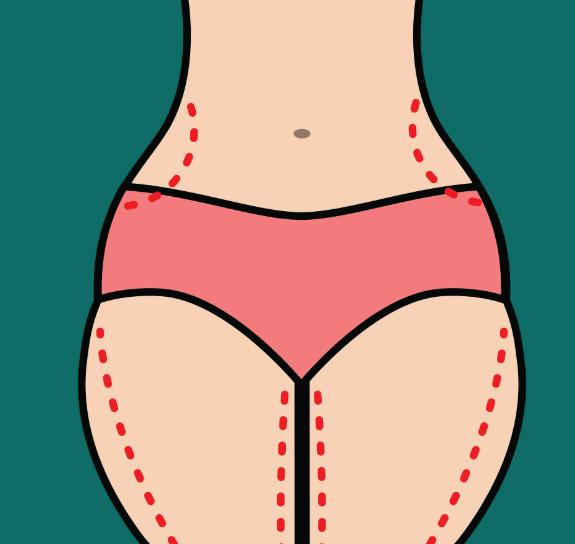 义乌腰部吸脂价格大公开：我花13200元起，双侧腰+后腰全包，成效太香了！