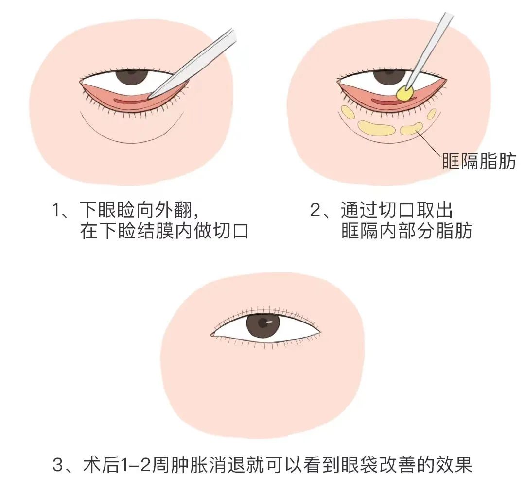 三、杜园园与其他医生的修复疗效对比