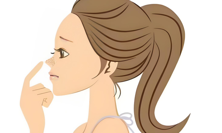 潘峰隆鼻技術3.0分段式值不值得做？從用戶需求看適配性www.cnxhy.cn