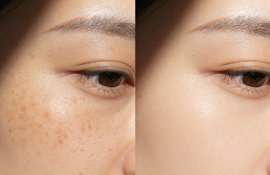 四、总结：理性看待皮肤管理价格与疗效