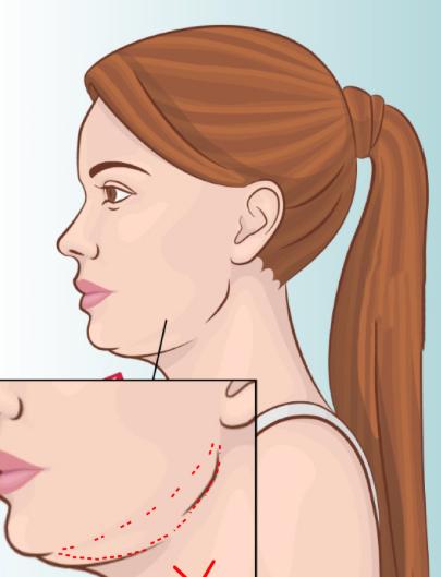 面吸前必須完成的4項關(guān)鍵體檢www.cnxhy.cn