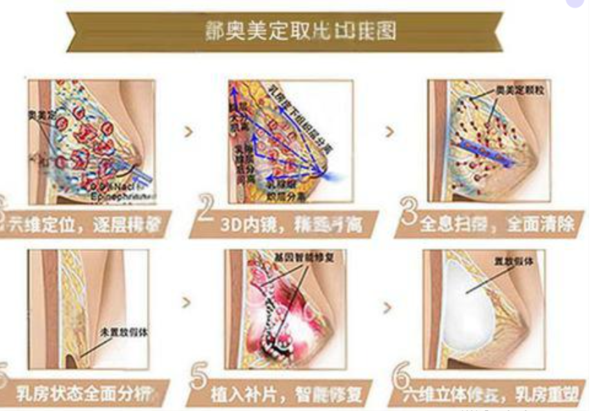 广州荔湾人民医院取奥美定不干净是谣言