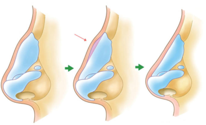 五、常见问题解答：从价格到变好期