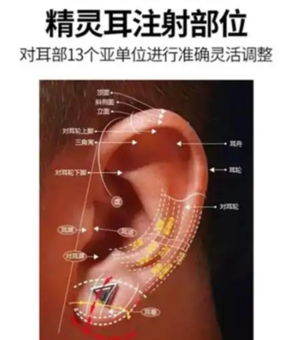 三、国内私立医院精灵耳技术对比