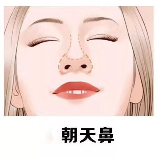 全國(guó)鼻修復(fù)大佬一次說 10 個(gè)名單來了！2025 真實(shí)榜單：向宏偉、巫文云、劉彥軍、李信鋒等全上榜！