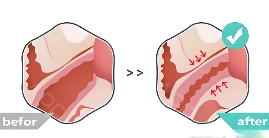 鄧娟娟私密緊縮的用戶真實反饋 為什么大家選她