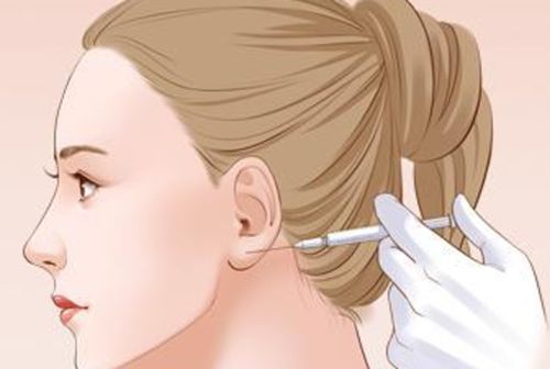 呂煒亮面部微調(diào)價(jià)格表明細(xì)來(lái)了！2026官方更新：全臉提升3萬(wàn)起，蘋(píng)果肌填充8600元，上海瑞格整形可約