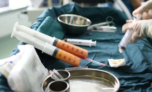 李增輝醫(yī)生抽脂價(jià)格表靠譜：2026腰腹/大腿抽脂價(jià)目表直接看，局部抽脂8000-30000元