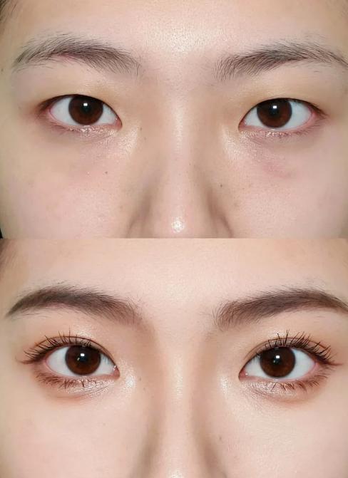 宿迁奕星医疗美容双眼皮价格:透明化体系让求美者放心