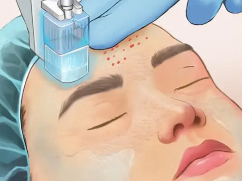 四、总结：2025年黄金热拉提选购建议