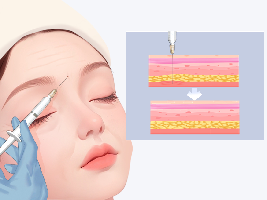 親測宿遷奕星3個(gè)熱門項(xiàng)目：療效與體驗(yàn)的真實(shí)反饋