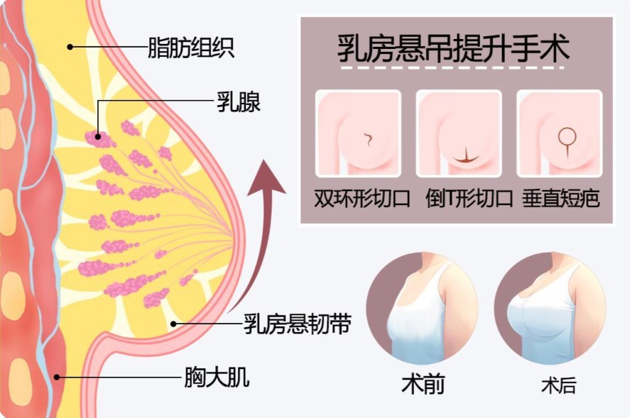 四、过来人的血泪建议