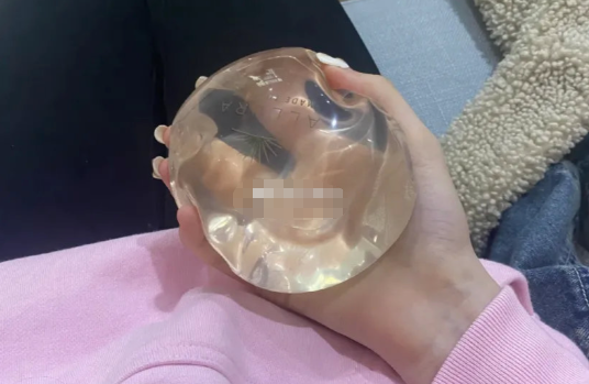 三、乳房再造手术的技术细节与患者关怀www.aimei.com