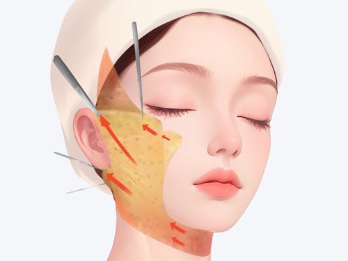 上海王洪内窥镜提升避坑没必要