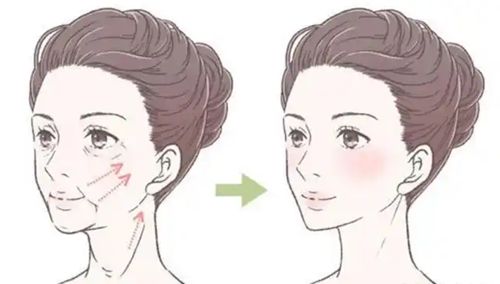 上海王洪内窥镜提升避坑无必要