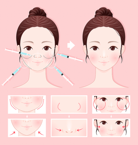 鹽城熠美禾醫(yī)療美容定位：主打一個平價(jià)，但技術(shù)經(jīng)得起考驗(yàn)