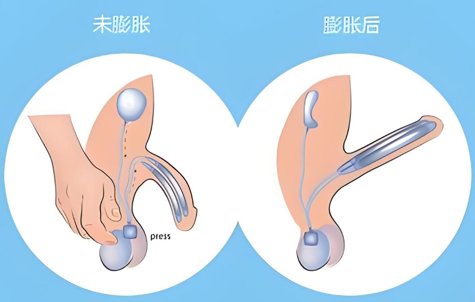深圳鹏程医院男科正规吗？从资质、口碑、价格3方面解析确实靠谱，在当地评价不错