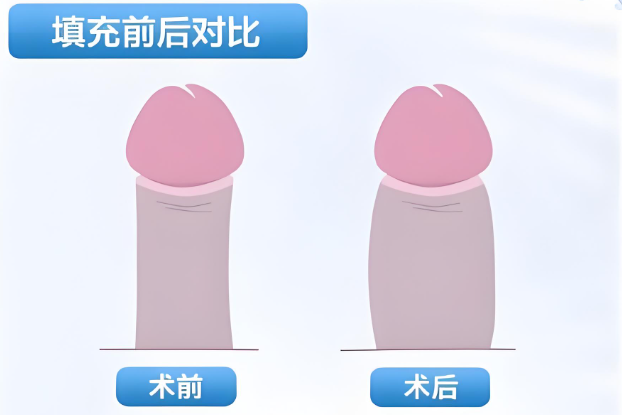 四、探访深圳鹏程医院男科医生团队:专门背景与诊疗特色