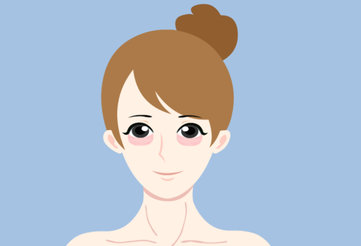 自體脂肪vs玻尿酸豐臥蠶：我花8000塊買來的經(jīng)驗分享