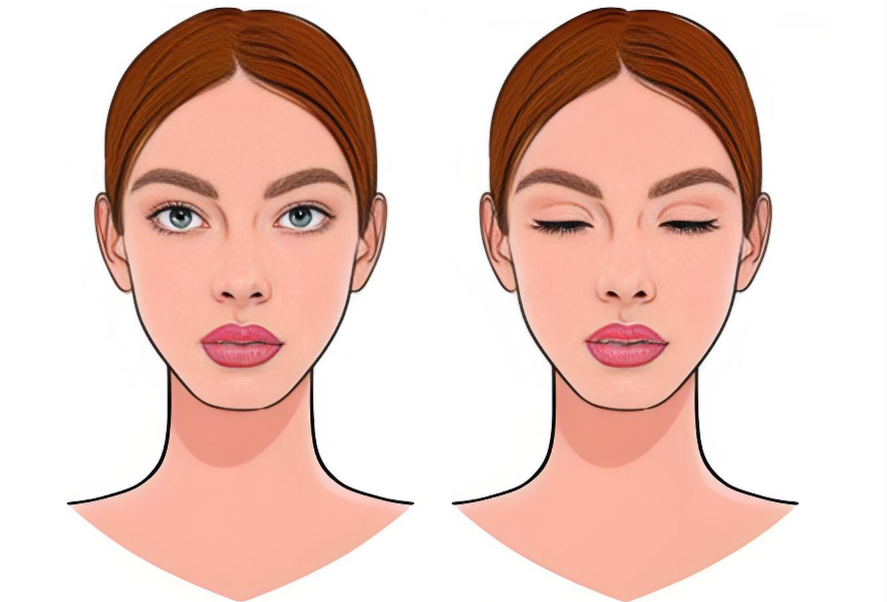 做了顴骨顴弓內(nèi)推鼻子會(huì)顯高嗎？醫(yī)生建議與注意事項(xiàng)www.cnxhy.cn