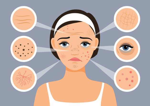 六、给祛斑新手的5条实用建议