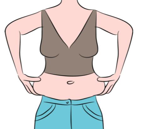 花了3万在军大做腹壁整形，赵善军大夫的技术对得起价格吗？