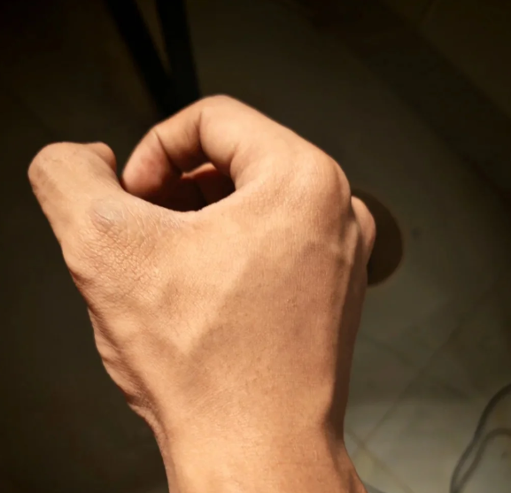 二、吕伟医生详解：影响男科手术疼痛的4大关键因素