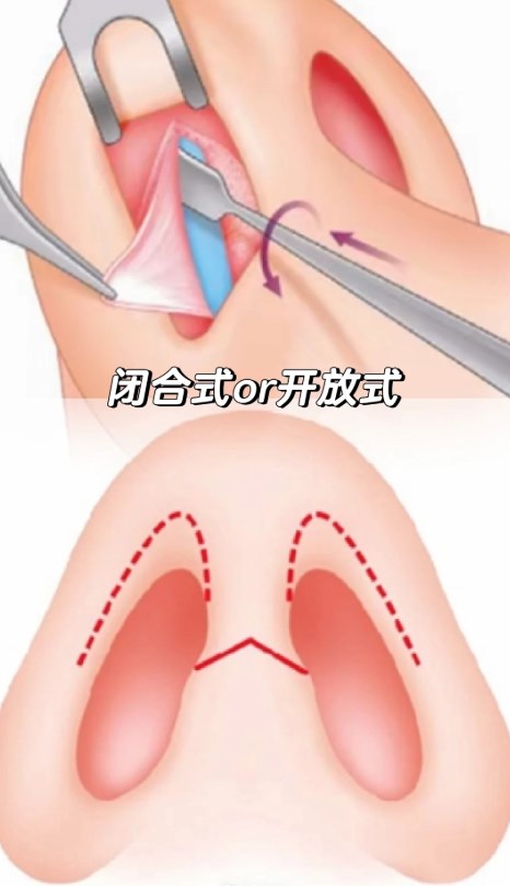 四、岳伟博士团队背景与技术创新