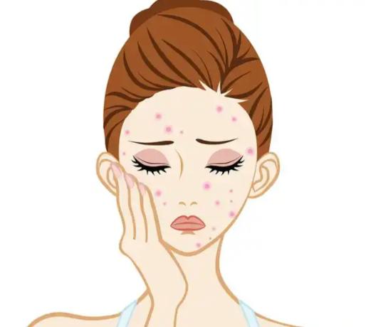 祛胎记后凹坑疤痕能修复吗？常见误区要避免