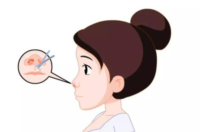 鼻修复别乱选！周口这3家医院专做修复