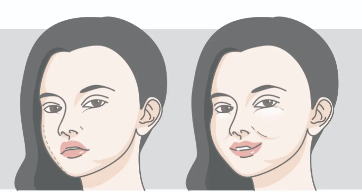 二、关于上海吕东和韩可旺医生馒化修复的收费情况