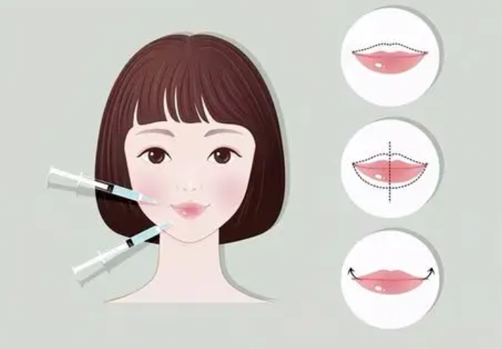 三、上海丽质卢九宁做唇修复的就诊全流程指南
