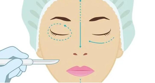 2026泸州琳美紫馨整形价格表：双眼皮/眼袋/鼻整形等8大项目收费全解析