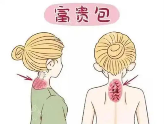 必看避坑指南：这些要点决定术后平整度
