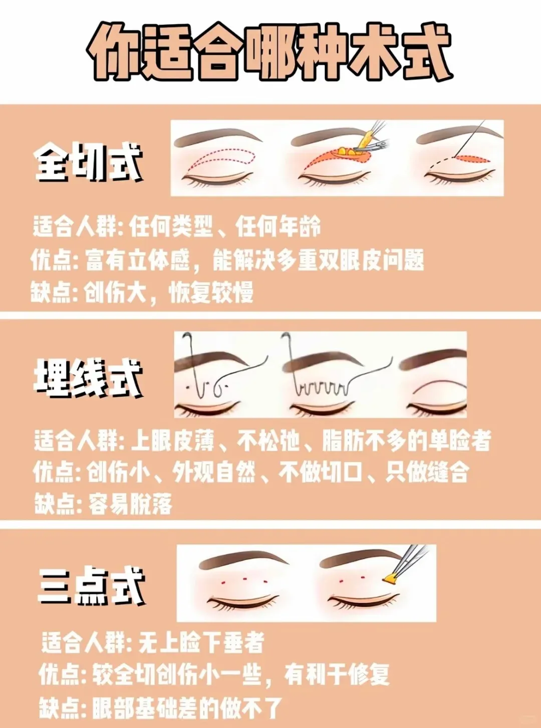 二、关于何永强双眼皮项目的收费明细
