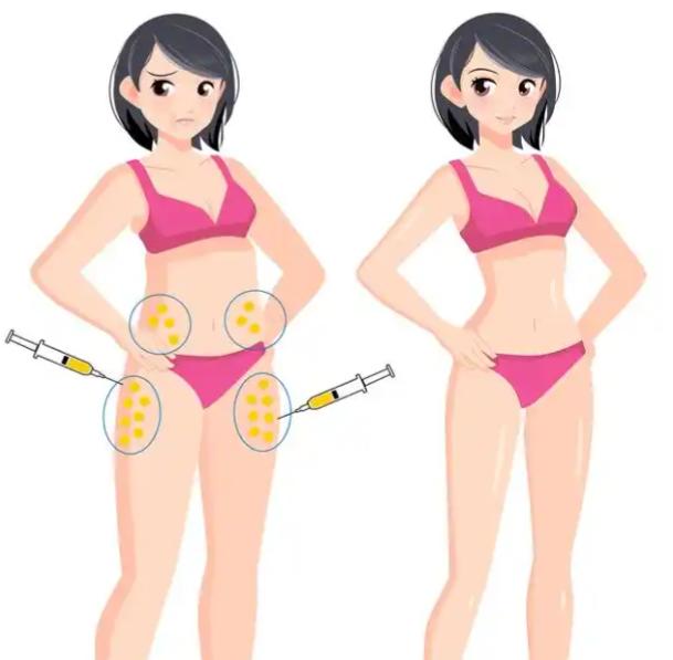 刘中国吸脂国内排名前十，采用5G天使光雕+动态美学设计，术后无凹凸、皮肤紧致不松弛！