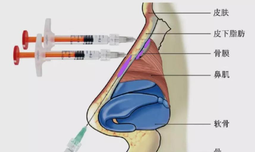 杭州郭江花医生预约攻略与到院指南
