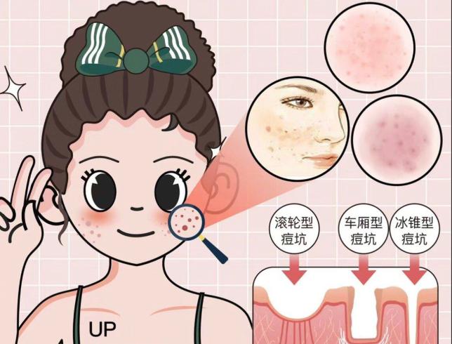 三、李翠华医生痘坑治疗适合人群www.aimei.com