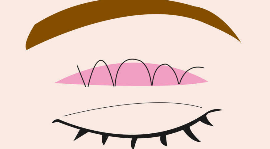 四、如何判断自己是否适合王恒医生的修复技术？