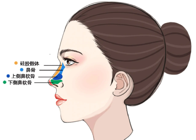 二、术后疗效的自然度是否经得起时间检验？