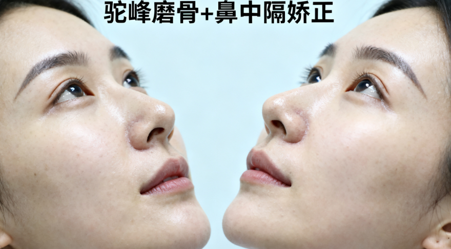 关于上海黄烈文医生做鼻子口碑如何？用户较常问的几个问题（FAQ）