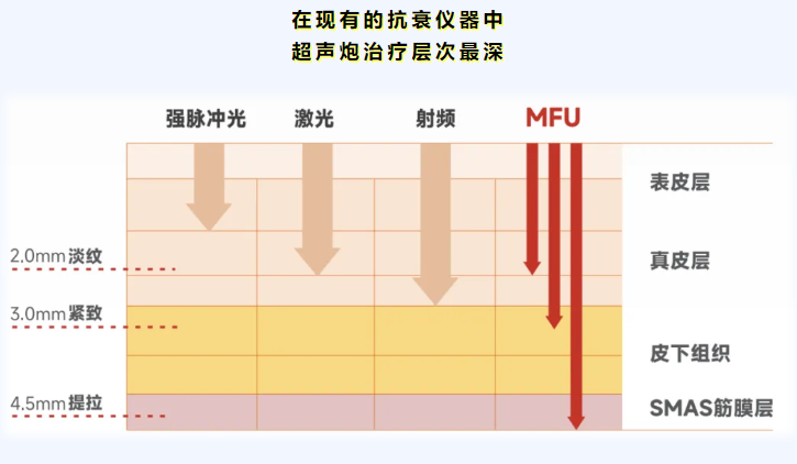 关于哈尔滨超声炮认证医生有哪些，用户较常问的几个问题（FAQ）