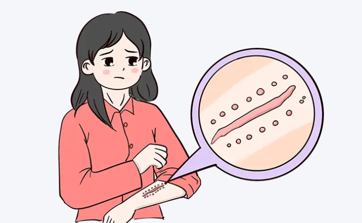 3、武汉五洲莱美:激光疤痕修复的技术先锋