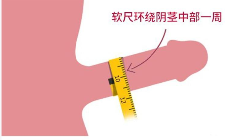 三、 上海德琳男性私密整形服务流程:从“社恐”到“社牛”的转变