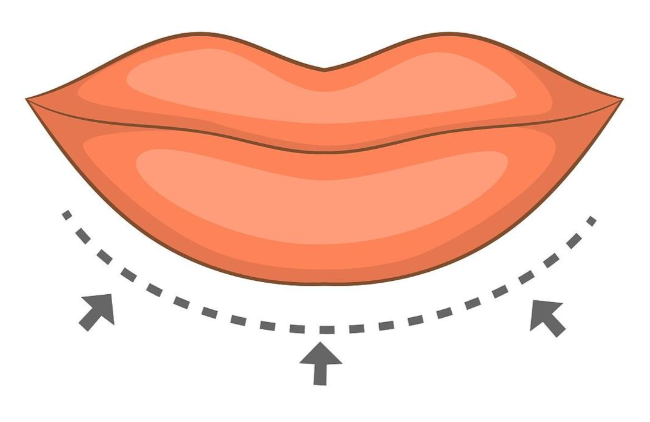 张森林医生在上海哪个医院？安缦/瑞欧/时光三家正规机构！主阵地安缦案例多，专做人中缩短+嘴角上扬！