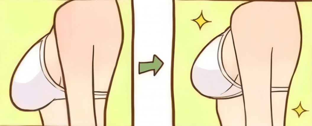 重慶華美曹勇縮胸怎麼樣？深挖「縮胸+提拉」二合一方案，補全乳房下垂矯正的預期效果