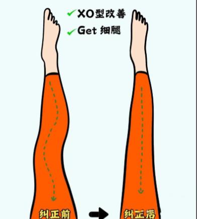 成都李烈直腿术怎么样?28800元起矫正O/XO型腿!吸脂+筋膜松解+脂肪加减法,效果维持5年以上!